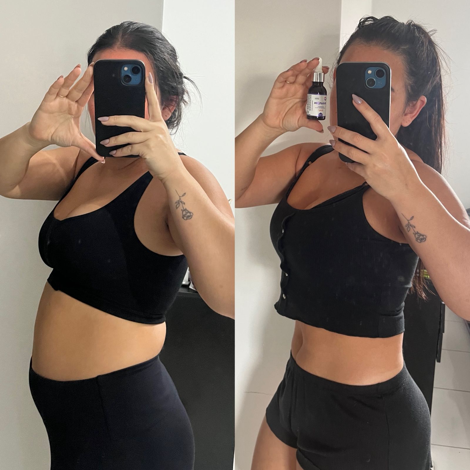 Antes e depois Ozenvitta - Resultado real 1