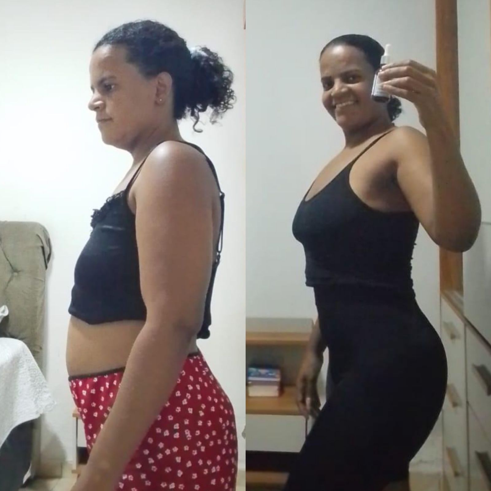 Antes e depois Ozenvitta - Resultado real 2