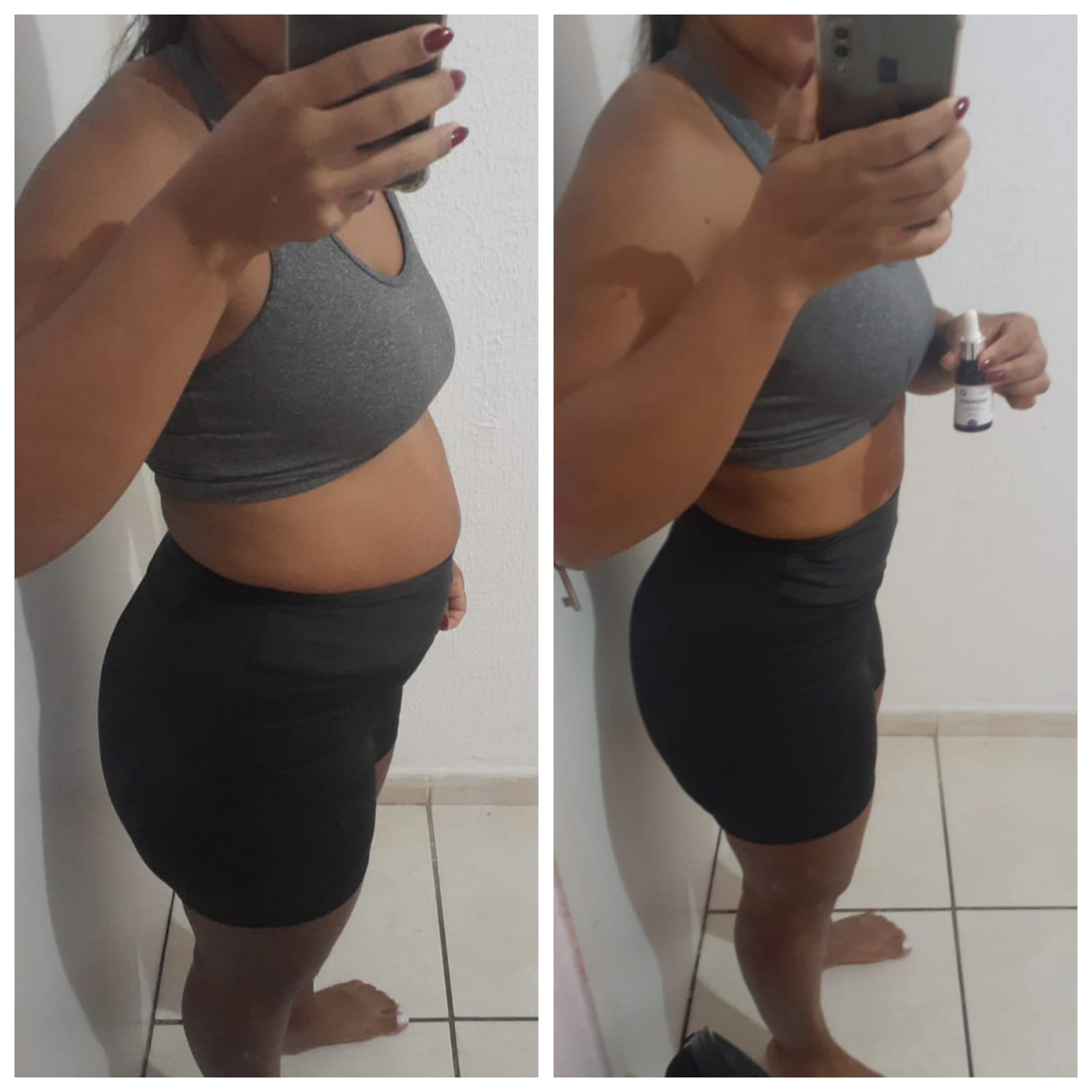 Antes e depois Ozenvitta - Resultado real 3