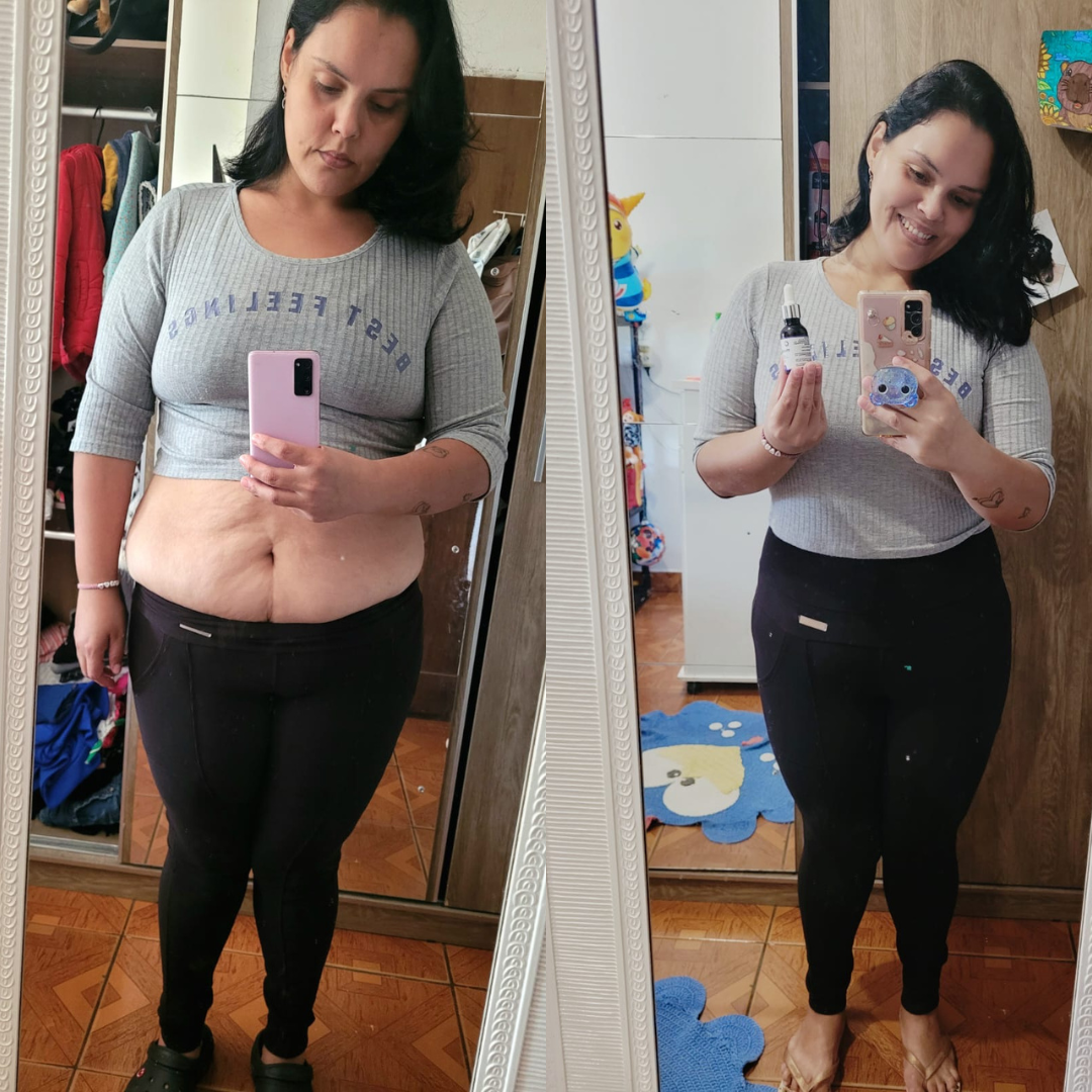 Antes e depois Ozenvitta - Resultado real 4