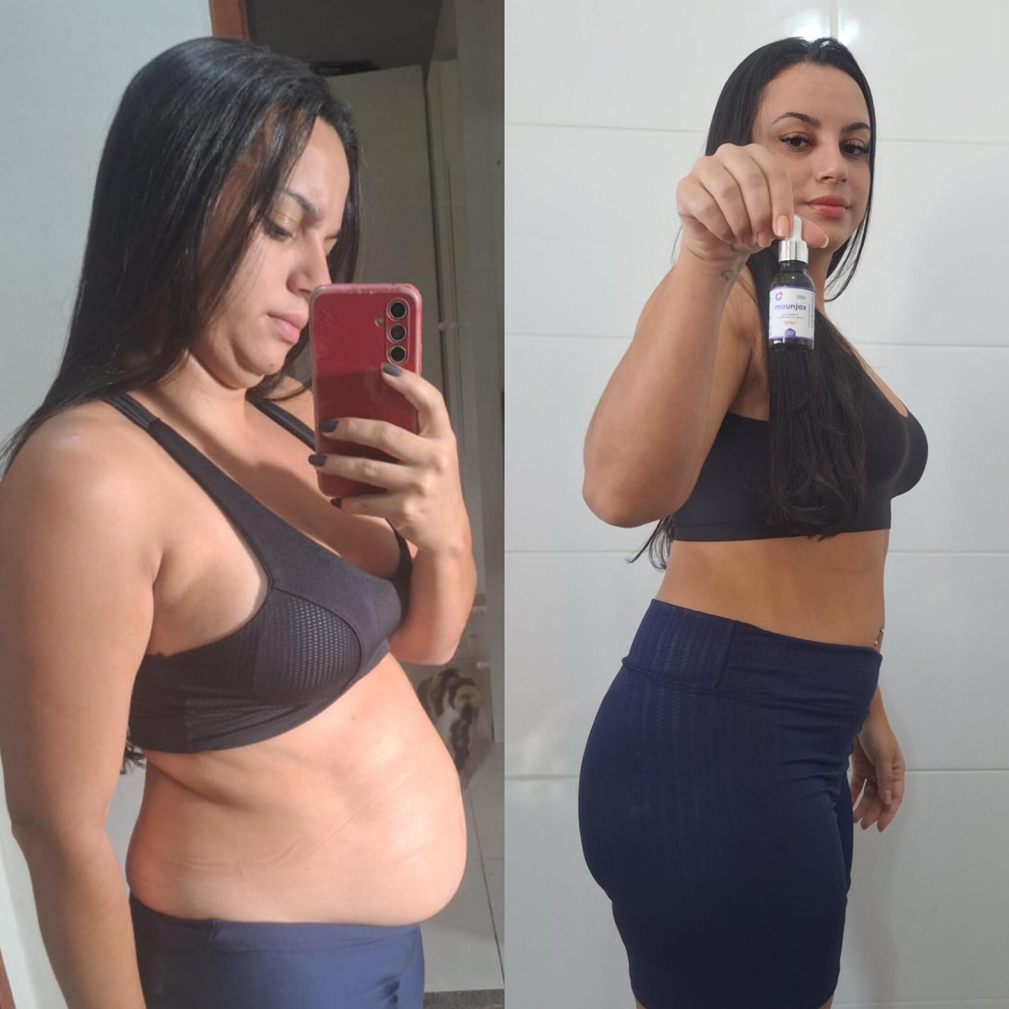 Antes e depois Ozenvitta - Resultado real 5